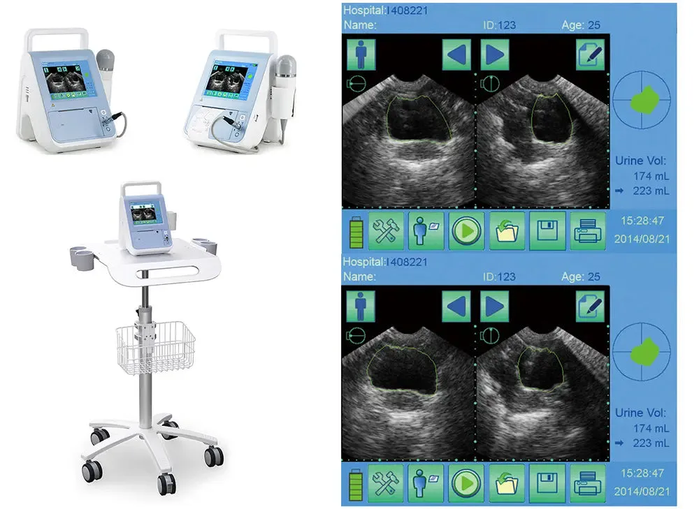 Bladder Volume Tester I BVT01