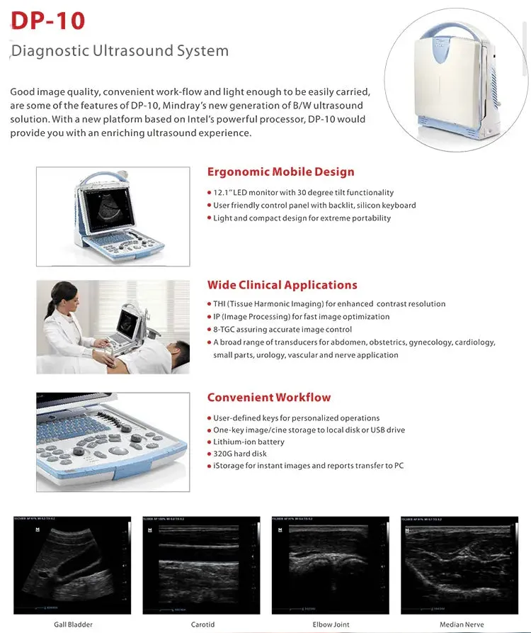 Veterinary Ultrasound BW Mindray DP10 Portable Multi-Application High Quality Bestseller Rated Scanner