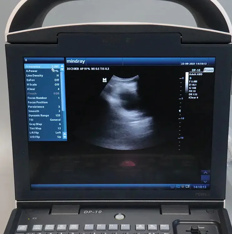 Veterinary Ultrasound BW Mindray DP10 Portable Multi-Application High Quality Bestseller Rated Scanner